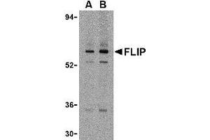 Western blot analysis of FLIP in K562 cell lysate with AP30341PU-N FLIP antibody at (A) 1 and (B) 2 μg/ml. (FLIP Antikörper  (N-Term))