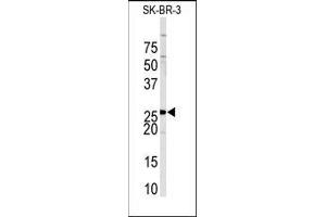 Western blot analysis of anti-SPRY4 Antibody (C-term) in Sk-Br-3 cell line lysates (35ug/lane). (SPRY4 Antikörper  (C-Term))