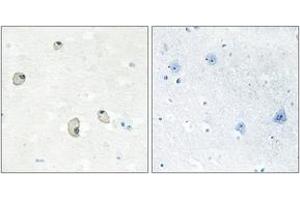 Immunohistochemistry analysis of paraffin-embedded human brain tissue, using CDH22 Antibody. (CDH22 Antikörper  (AA 111-160))