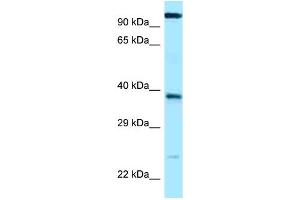 WB Suggested Anti-LOC647589 Antibody Titration: 1. (ANHX Antikörper  (C-Term))
