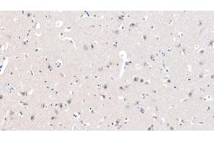 Detection of CHRNa7 in Human Cerebrum Tissue using Polyclonal Antibody to Cholinergic Receptor, Nicotinic, Alpha 7 (CHRNa7)
