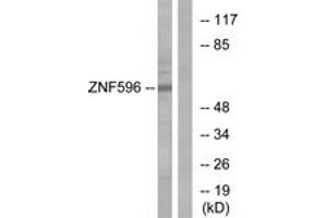 Western Blotting (WB) image for anti-Zinc Finger Protein 596 (ZNF596) (AA 261-310) antibody (ABIN2879157) (ZNF596 Antikörper  (AA 261-310))