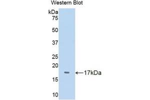 Western blot analysis of the recombinant protein. (TTR Antikörper  (AA 20-147))