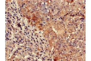 Immunohistochemistry of paraffin-embedded human adrenal gland tissue using ABIN7161691 at dilution of 1:100 (TYK2 Antikörper  (AA 286-372))