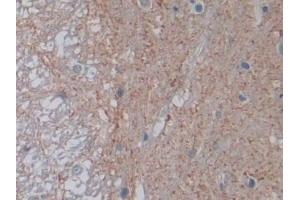 Detection of PTPRB in Rat Spinal cord Tissue using Polyclonal Antibody to Protein Tyrosine Phosphatase Receptor Type B (PTPRB)