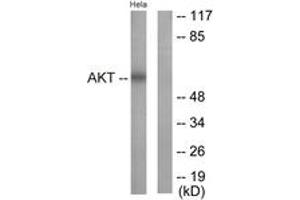 Western blot analysis of extracts from HeLa cells, treated with Insulin 0. (AKT1 Antikörper  (AA 292-341))