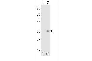 Western blot analysis of SULT1A1 (arrow) using rabbit polyclonal SULT1A1 Antibody  (ABIN389136 and ABIN2839312). (SULT1A1 Antikörper  (AA 128-160))
