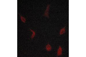 ABIN6268894 staining lovo cells by ICC/IF. (TGFBR1 Antikörper  (Internal Region))