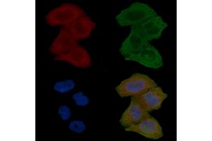 ABIN7094520 and ABIN7098569 staining Hela cells(24h of starvation treatment) by IF/ICC. (HTR7 Antikörper  (N-Term))