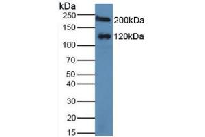 Figure. (Maltase-Glucoamylase (MGAM) (AA 213-392) Antikörper)