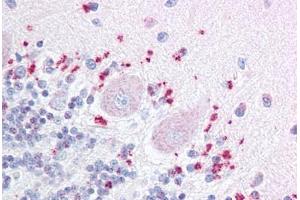 Immunohistochemistry (IHC) image for anti-Wingless-Type MMTV Integration Site Family, Member 7A (WNT7A) (Internal Region) antibody (ABIN1049483)
