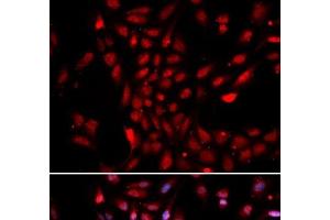 Immunofluorescence analysis of U2OS cells using KPNA4 Polyclonal Antibody (KPNA4 Antikörper)