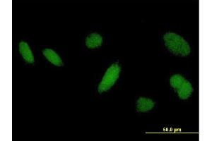 Immunofluorescence of purified MaxPab antibody to DHRSX on HeLa cell. (DHRSX Antikörper  (AA 1-330))