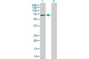 Western Blotting (WB) image for ESR1 293T Cell Transient Overexpression Lysate(Denatured) (ABIN1331738)