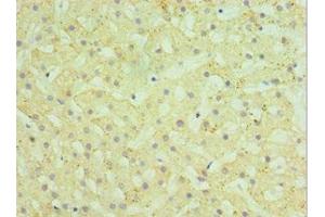 Immunohistochemistry of paraffin-embedded human liver tissue using ABIN7155970 at dilution of 1:100 (HYAL1 Antikörper  (AA 136-435))
