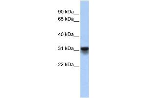 Western Blotting (WB) image for anti-KDEL (Lys-Asp-Glu-Leu) Endoplasmic Reticulum Protein Retention Receptor 3 (kDELR3) (Middle Region) antibody (ABIN2782741)