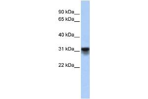 WB Suggested Anti-KDELR3 Antibody Titration:  0. (KDELR3 Antikörper  (Middle Region))