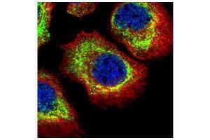 ICC/IF Image Confocal immunofluorescence analysis (Olympus FV10i) of methanol-fixed A431, using alpha Adducin, antibody (Green) at 1:500 dilution. (alpha Adducin Antikörper)
