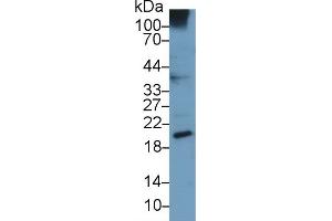 Detection of UCN3 in Human A549 cell lysate using Monoclonal Antibody to Urocortin 3 (UCN3) (UCN3 Antikörper  (AA 22-161))