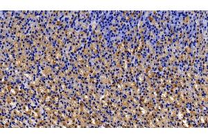 Immunohistochemistry (IHC) image for anti-Matrix Metallopeptidase 7 (Matrilysin, Uterine) (MMP7) (AA 1-267) antibody (ABIN7431020)