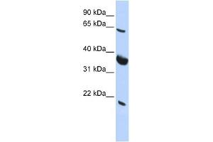 SRPR antibody used at 1 ug/ml to detect target protein.