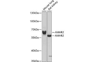 Western blot analysis of extracts of various cell lines, using  antibody  at 1:1000 dilution. (AMHR2 Antikörper  (AA 18-149))