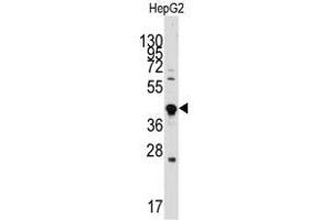 Image no. 2 for anti-Growth Differentiation Factor 3 (GDF3) (Center) antibody (ABIN357460)