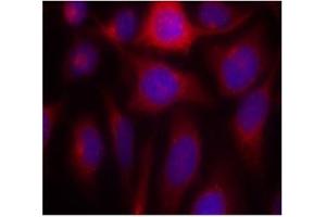 Image no. 2 for anti-Nitric Oxide Synthase 3 (Endothelial Cell) (NOS3) (Ser1177) antibody (ABIN319320) (ENOS Antikörper  (Ser1177))