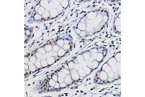 Immunohistochemistry of paraffin-embedded human colon using METTL14 Rabbit pAb (ABIN6131104, ABIN6143759, ABIN6143760 and ABIN6224625) at dilution of 1:100 (40x lens). (METTL14 Antikörper  (AA 1-210))