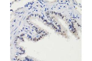 Immunohistochemistry of paraffin-embedded Rat lung using Phospho-Stat3(S727) Polyclonal Antibody at dilution of 1:100 (40x lens). (STAT3 Antikörper  (pSer727))