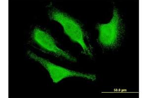 Immunofluorescence (IF) image for anti-Cyclin-Dependent Kinase 5, Regulatory Subunit 1 (p35) (CDK5R1) (AA 208-307) antibody (ABIN563839)
