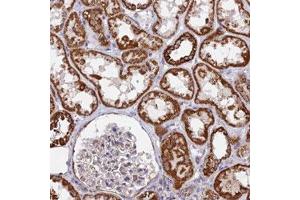 Immunohistochemical staining (Formalin-fixed paraffin-embedded sections) of human kidney with CDC16 polyclonal antibody  shows strong cytoplasmic positivity in cells in tubules. (CDC16 Antikörper)