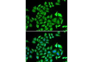 Immunofluorescence analysis of U2OS cell using PSMA3 antibody. (PSMA3 Antikörper)