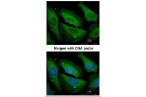 ICC/IF Image Immunofluorescence analysis of paraformaldehyde-fixed HeLa, using PP1 gamma, antibody at 1:200 dilution. (PPP1CC Antikörper  (Center))