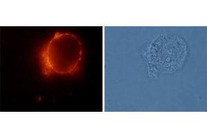 Immunocytochemistry (ICC) image for anti-Angiotensin II Receptor, Type 2 (AGTR2) (AA 21-35), (Extracellular) antibody (ABIN7042925)