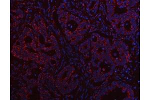 IF analysis of PTPIP51/RMDN3 using anti-PTPIP51/RMDN3 antibody (ABIN7601775). (RMDN3 Antikörper  (AA 45-438))