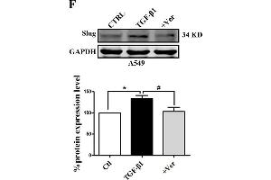 Slug is regulated by the co-transcriptional complex YAP1/TEAD in the EMT program of A549 cells. (GAPDH Antikörper)