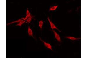 ABIN6274844 staining NIH-3T3 by IF/ICC. (ALS2CR11 Antikörper)