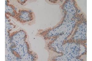 Immunohistochemistry (IHC) image for anti-phospholipase A2 Receptor 1, 180kDa (PLA2R1) (AA 1418-1487) antibody (ABIN7443389)