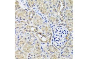 Immunohistochemistry of paraffin-embedded mouse kidney using CGB7 antibody. (CGB7 Antikörper  (AA 21-165))