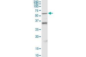 MDM4 MaxPab rabbit polyclonal antibody. (MDM4-binding Protein Antikörper  (AA 1-490))