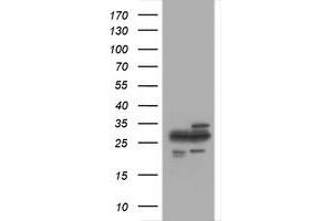 Image no. 1 for anti-Proteasome Subunit alpha 2 (PSMA2) (AA 50-234) antibody (ABIN1491569) (PSMA2 Antikörper  (AA 50-234))