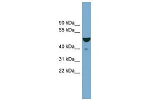 FBXO9 antibody used at 1 ug/ml to detect target protein. (FBXO9 Antikörper  (Middle Region))