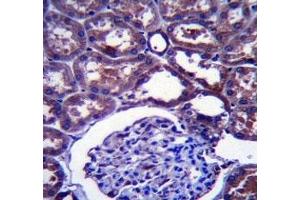 Immunohistochemistry (IHC) image for anti-Niemann-Pick Disease, Type C1 (NPC1) (AA 591-620) antibody (ABIN3031998)