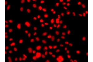 Immunofluorescence analysis of  cells using PRICKLE2 antibody (ABIN6133166, ABIN6146162, ABIN6146163 and ABIN6224046). (PRICKLE2 Antikörper  (AA 615-844))