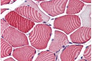 Human Skeletal Muscle (formalin-fixed, paraffin-embedded) stained with TBC1D4 antibody ABIN351486 at 3. (TBC1D4 Antikörper  (AA 825-837))
