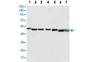 Western blot analysis using TP63 monoclonal antobody, clone 4E5  against A-431 (1), HeLa (2), Jurkat (3), THP-1 (4), NIH/3T3 (5), COS-7 (6) and PC-12 (7) cell lysate. (p63 Antikörper)
