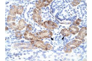 DMRTA2 antibody was used for immunohistochemistry at a concentration of 4-8 ug/ml to stain Epithelial cells of renal tubule (lndicated with Arrows) in Human Kidney.