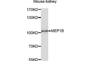 Western blot analysis of extracts of mouse kidney, using MEP1B antibody (ABIN6003791) at 1/1000 dilution. (Meprin B Antikörper)