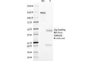 SDS-PAGE Analysis Purified Erythrocyte Specific Mouse Monoclonal Antibody (SFL23. (Erythrocyte Specific Antigen Antikörper)